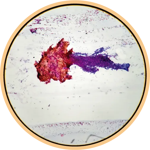 Cytopathology