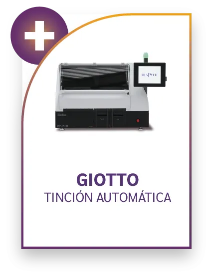 Imagen de Giotto Tincion Automatica